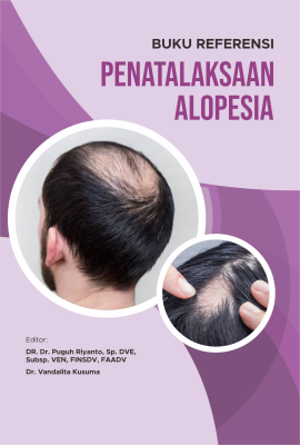 alopesia