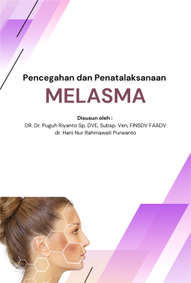 Melasma